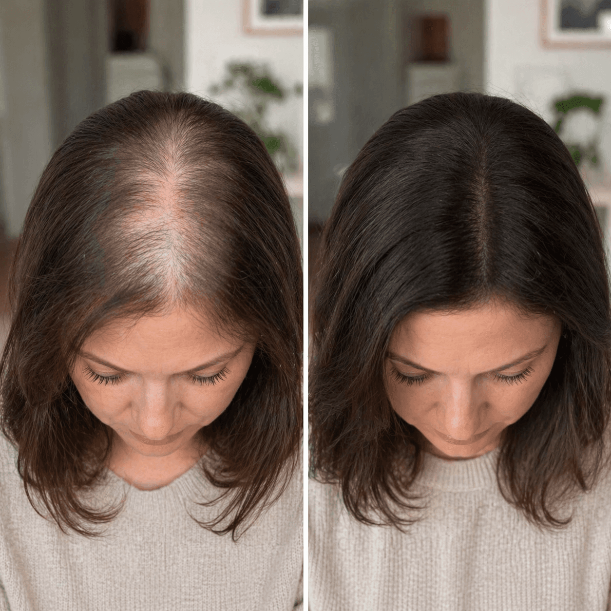 Resultado real 01 Renova Therapy