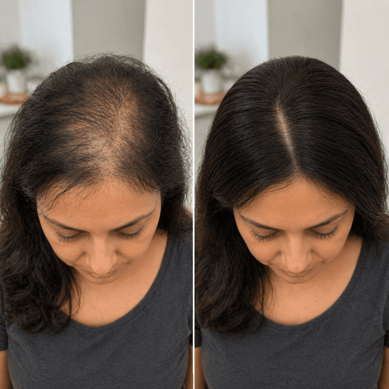 Resultado real 02 Renova Therapy