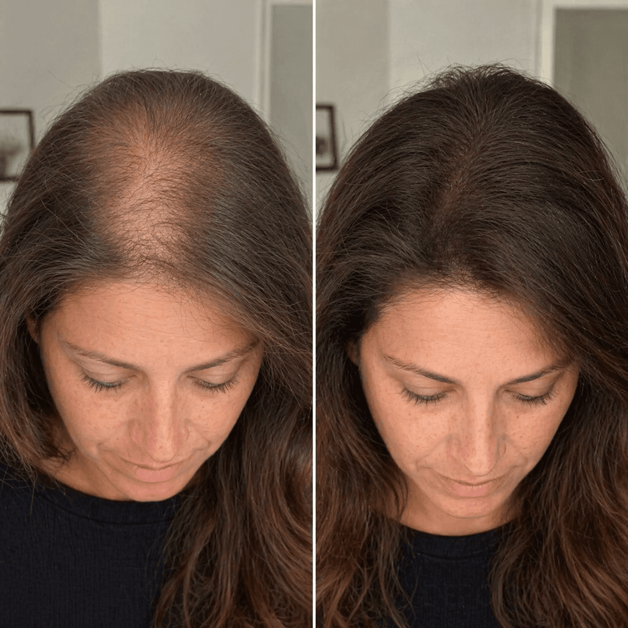 Resultado real 03 Renova Therapy