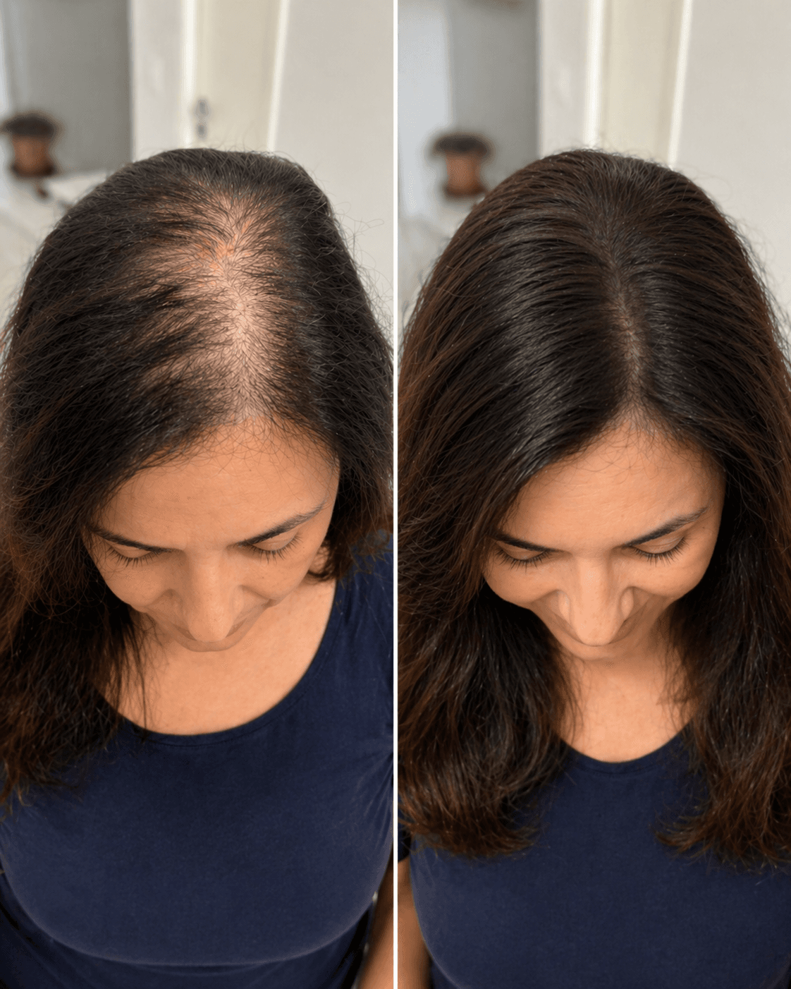 Resultado real 04 Renova Therapy